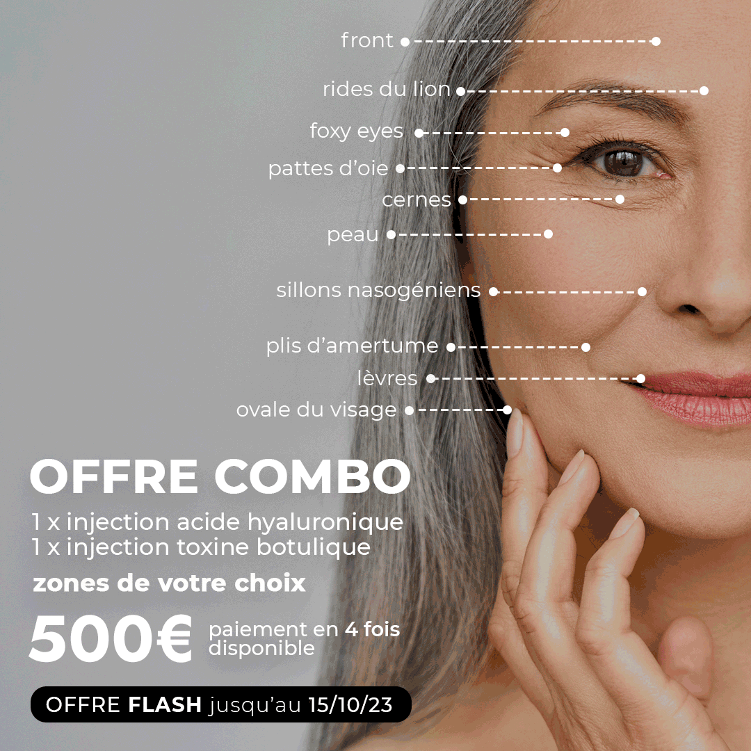 flash-combo-2