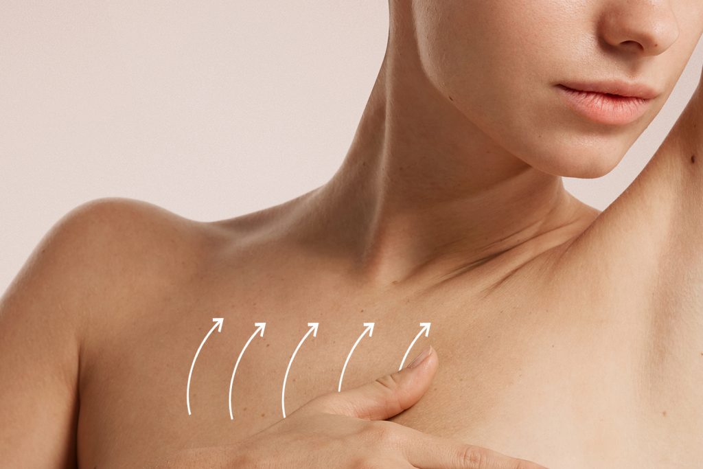 decolleté fils tenseurs croma